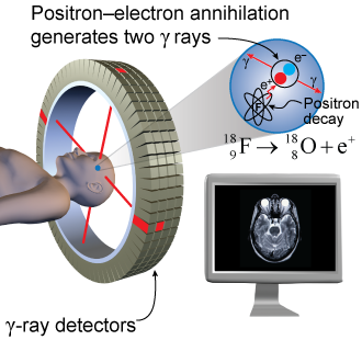 Positron emission tomography (PET)